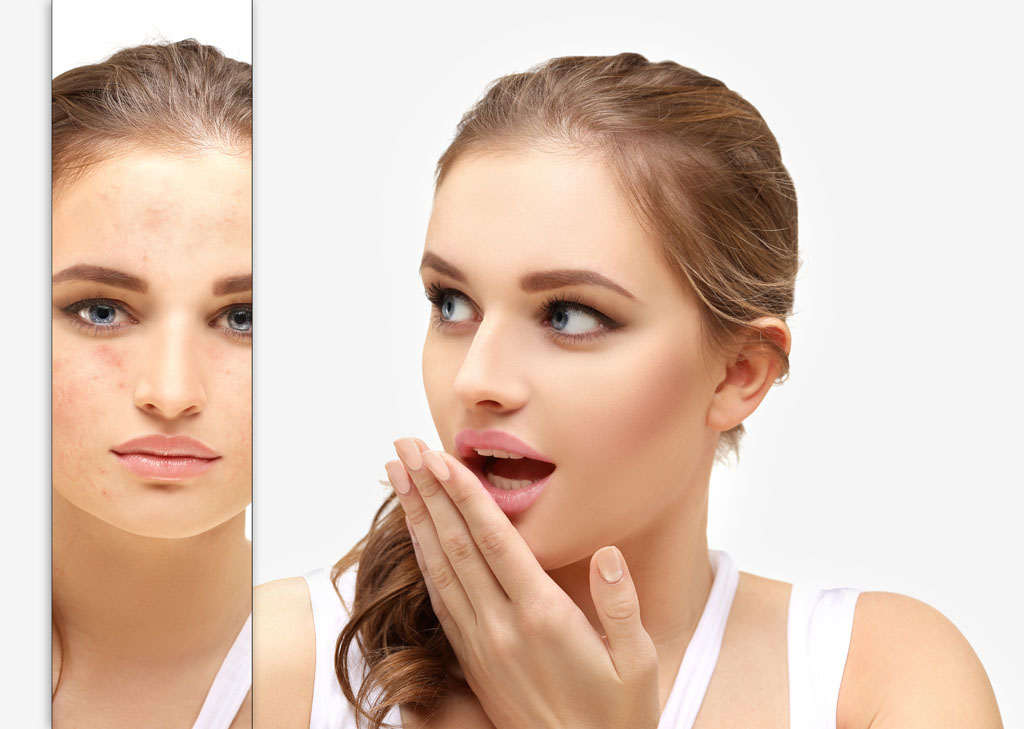 皮膚管理中心,木乃伊煥膚